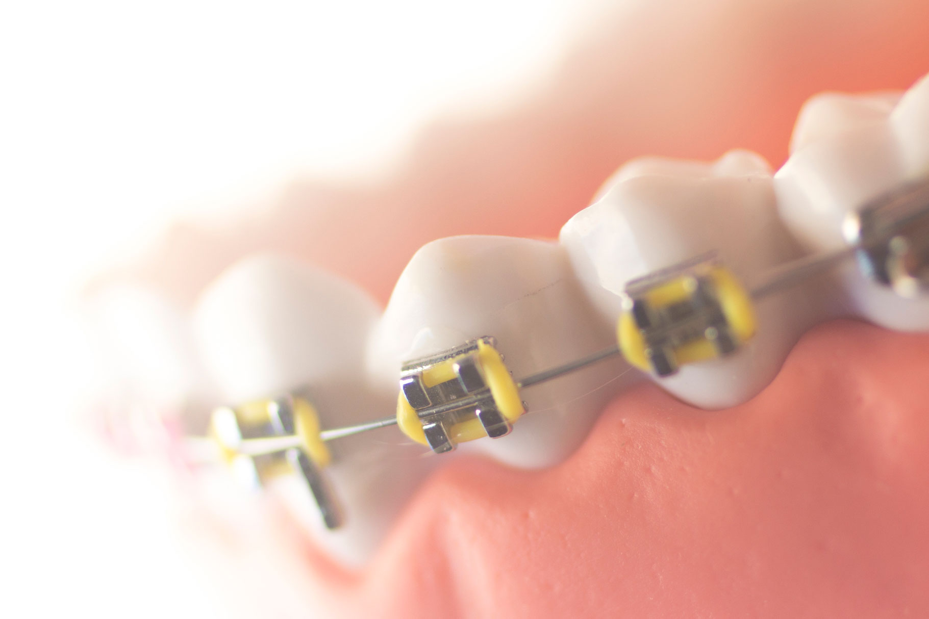 Ortodoncia en Los Realejos, Clínica dental en Los Realejos, Dentista en Los Realejos